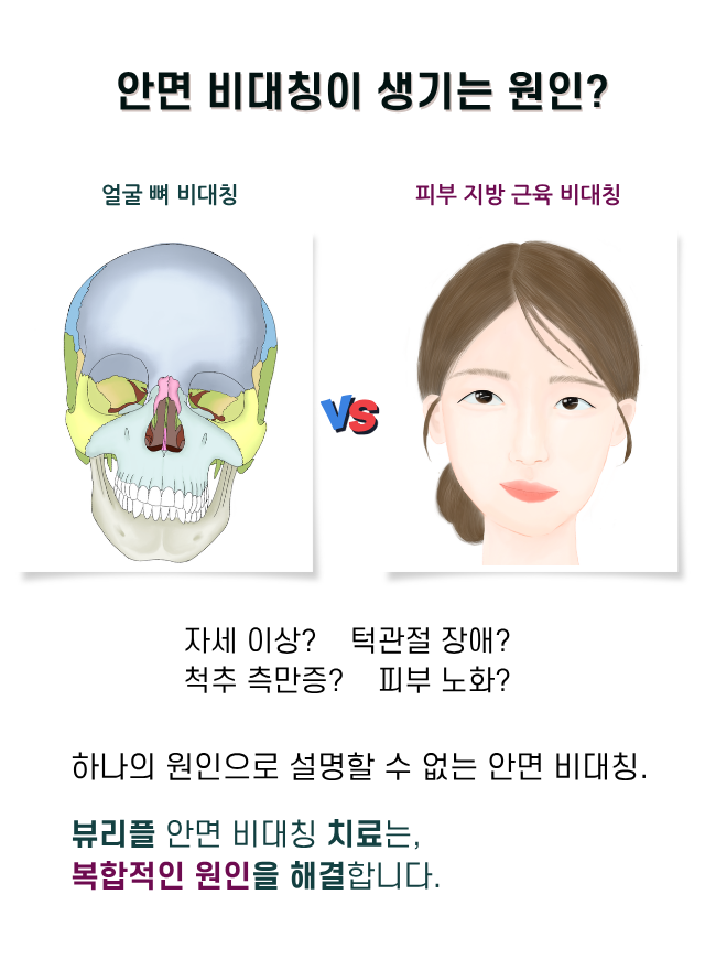 압구정 뷰리플한의원 안면 비대칭이 생기는 원인