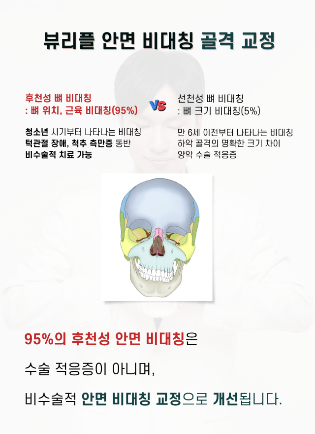압구정 뷰리플한의원 안면 비대칭 골격 교정