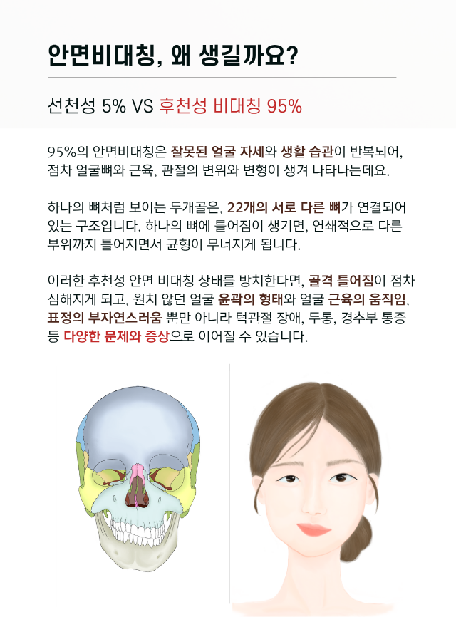 압구정 뷰리플한의원 안면비대칭 생기는 이유