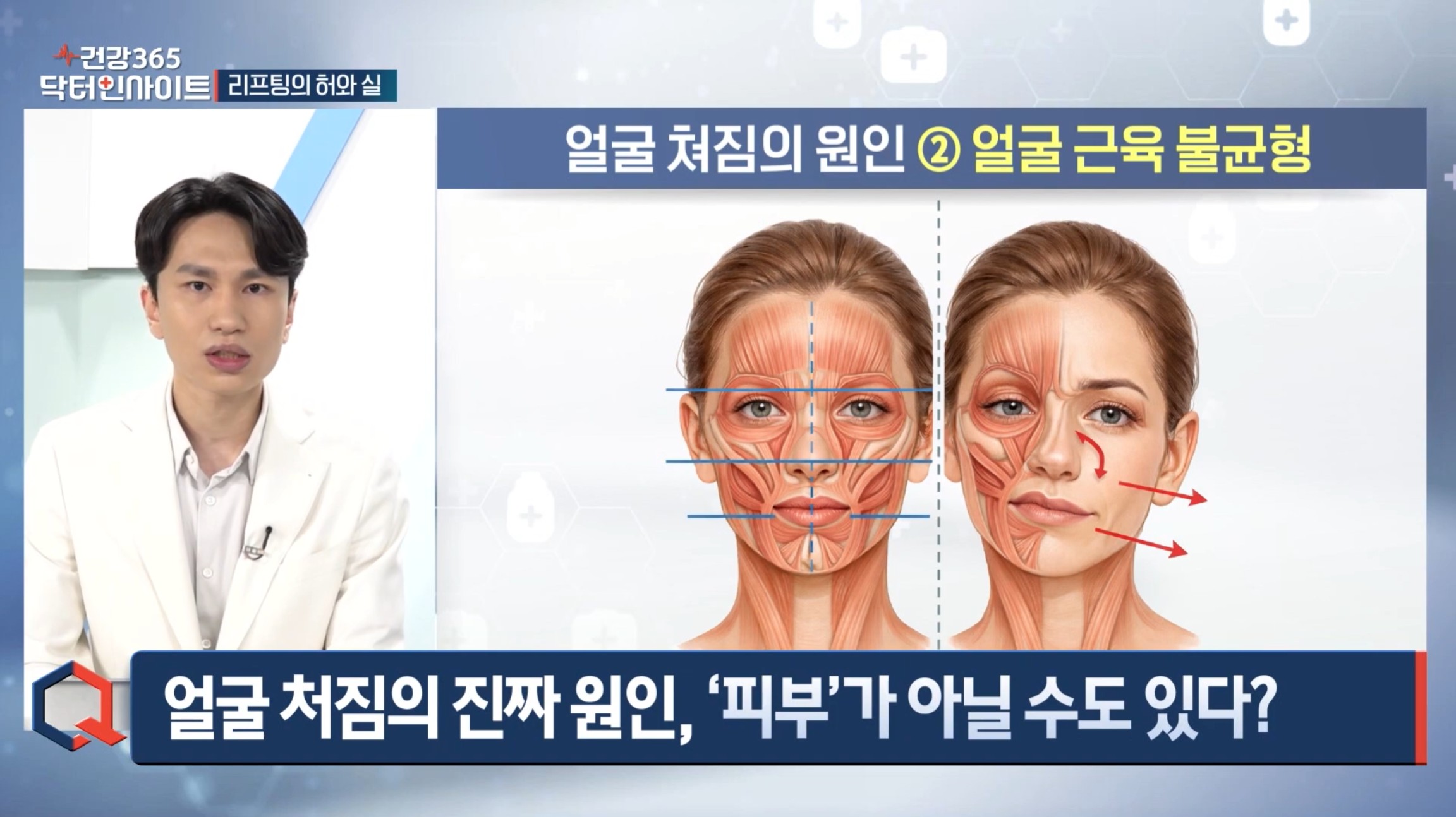 압구정 뷰리플한의원 닥터인사이트 리프팅 2