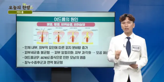 압구정 뷰리플한의원 오늘의 한방 여드름 - 2