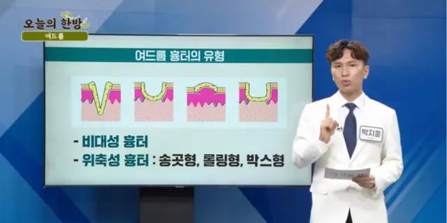압구정 뷰리플한의원 오늘의 한방 여드름 - 3