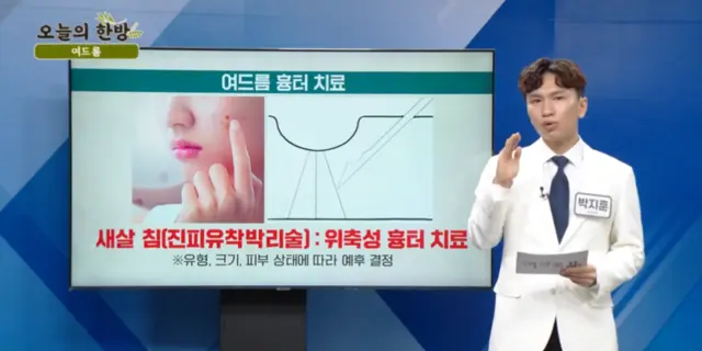 압구정 뷰리플한의원 오늘의 한방 여드름 - 4