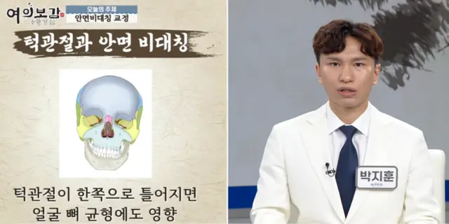 압구정 뷰리플한의원 여의보감 안면비대칭 - 3