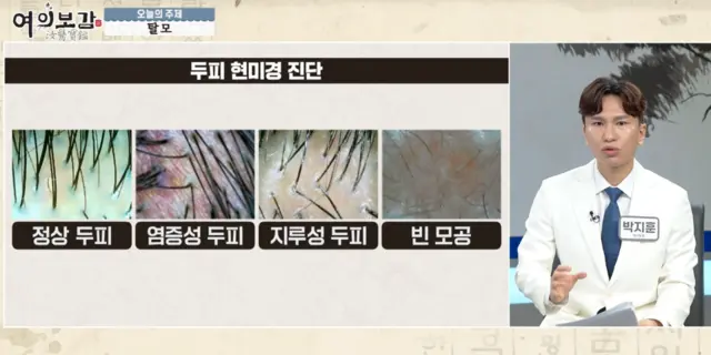 압구정 뷰리플한의원 여의보감 탈모 - 3