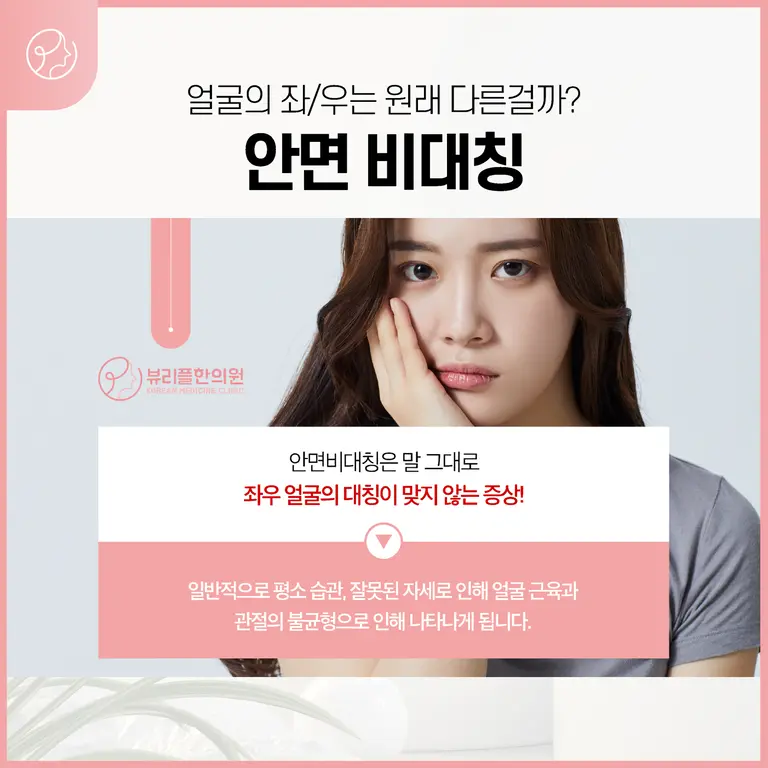 압구정 뷰리플한의원 안면비대칭