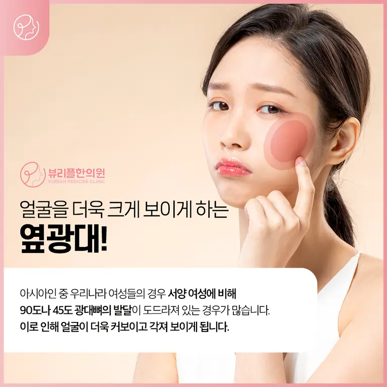 압구정 뷰리플한의원 옆광대