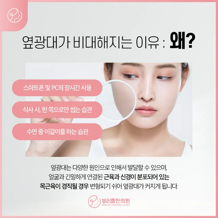 압구정 뷰리플한의원 옆광대 비대해지는 이유