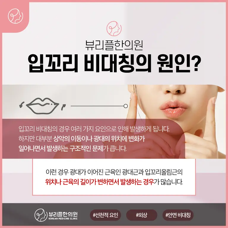 압구정 뷰리플한의원 입꼬리 비대칭 원인