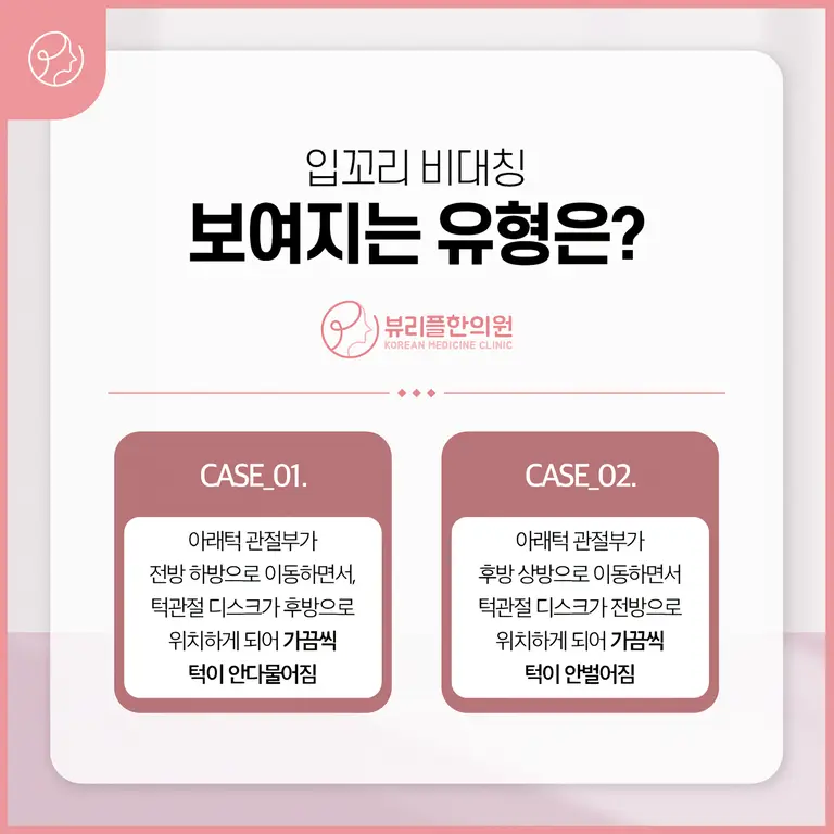 압구정 뷰리플한의원 입꼬리 비대칭 유형