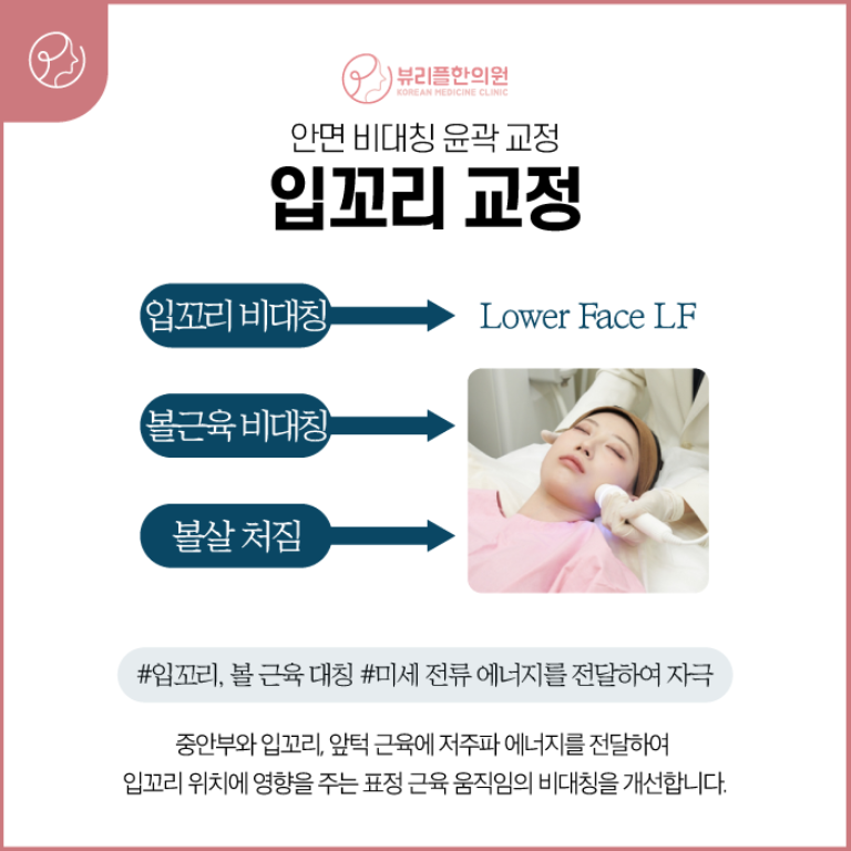 압구정 뷰리플한의원 안면 비대칭 윤곽 교정 입꼬리 교정