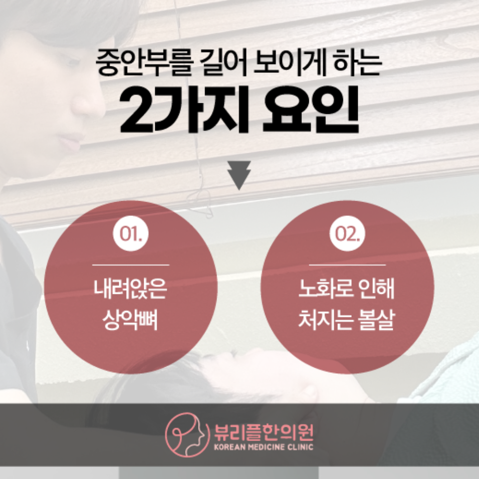 압구정 뷰리플한의원 중안부 길어보이는 요인