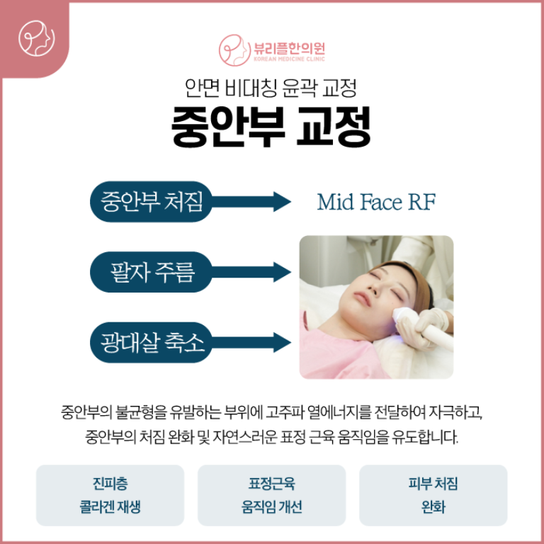 압구정 뷰리플한의원 중안부 교정 비포애프터