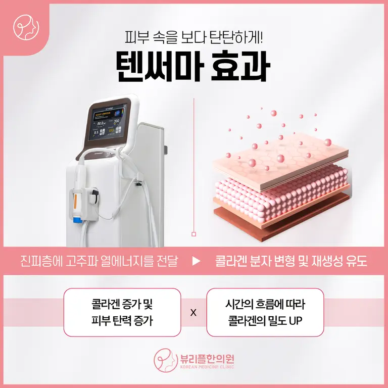 압구정 뷰리플한의원 텐써마 효과