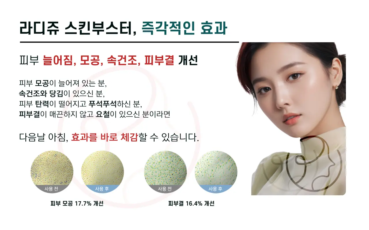 압구정 뷰리플한의원 라디쥬 스킨부스터 효과