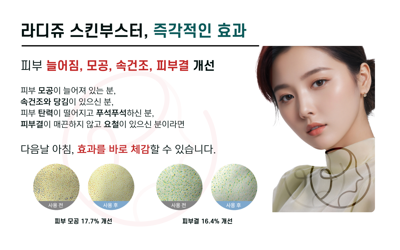 압구정 뷰리플한의원 라디쥬 스킨부스터 효과