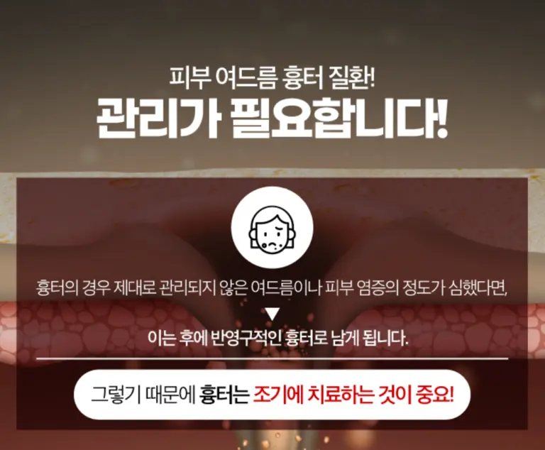 압구정 뷰리플한의원 피부 여드름 흉터 질환 관리