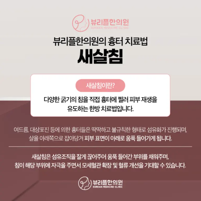 압구정 뷰리플한의원 새살침