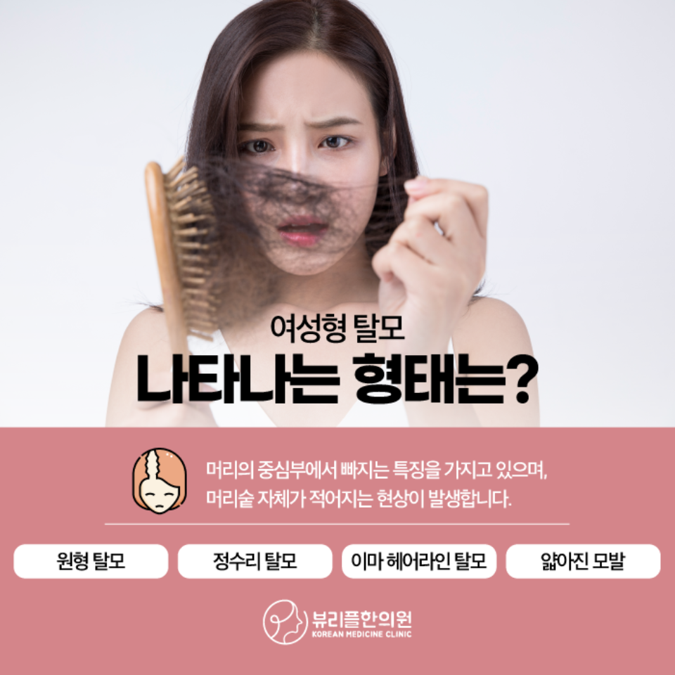 압구정 뷰리플한의원 여성형 탈모 형태