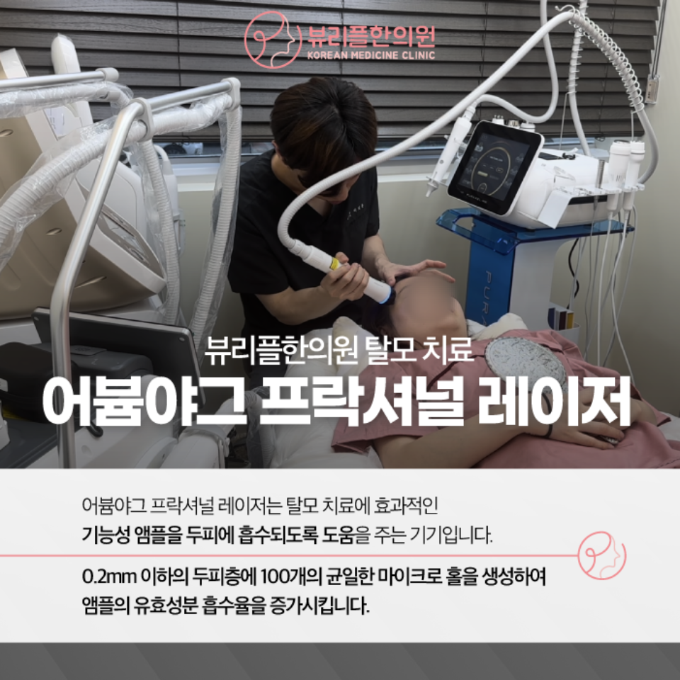 압구정 뷰리플한의원 탈모 치료 어븀야그 프락셔널 레이저