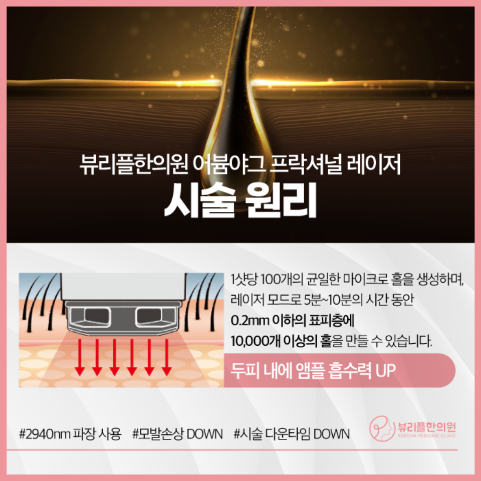 압구정 뷰리플한의원 어븀야그 프락셔널 레이저 시술 원리