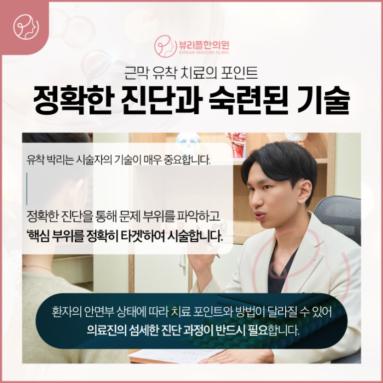 압구정 뷰리플한의원 근막 유착 치료의 포인트