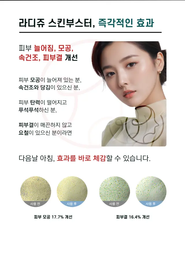 압구정 뷰리플한의원 라디쥬 스킨부스터 효과