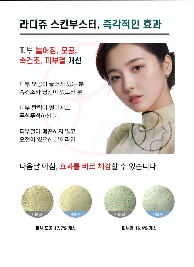 압구정 뷰리플한의원 라디쥬 스킨부스터 효과